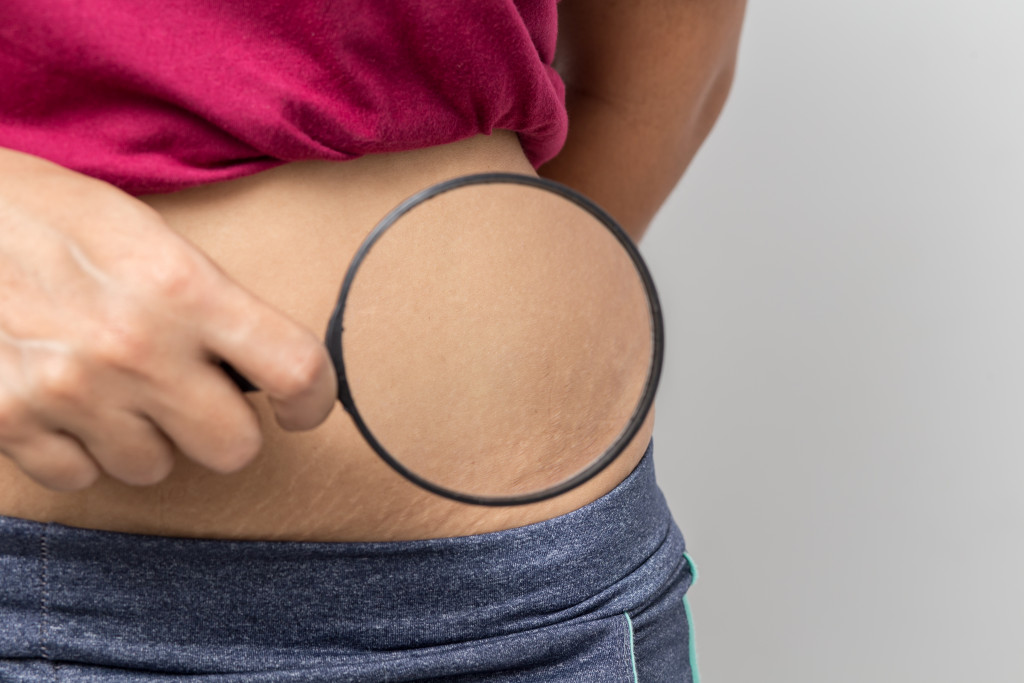 hand holds a magnifying glass over belly to show a lack of stretchmarks