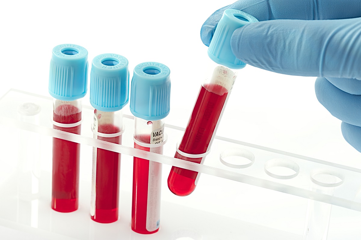 Blood on test tube